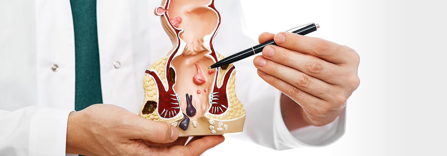 Anal Fistula Causes and Diagnostics